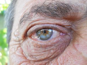 Elderly eye problems and senior eye care tips