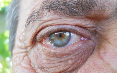 Senior Eye Care Problems and Prevention